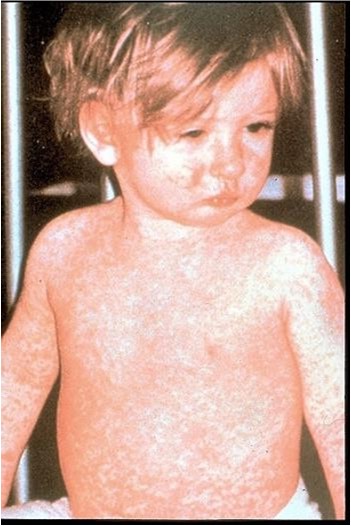 Child